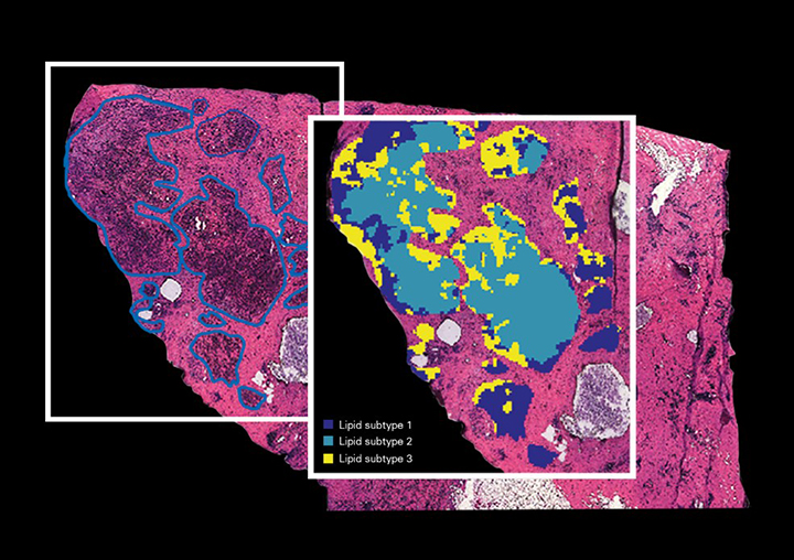 Image of an proteomic analysis
